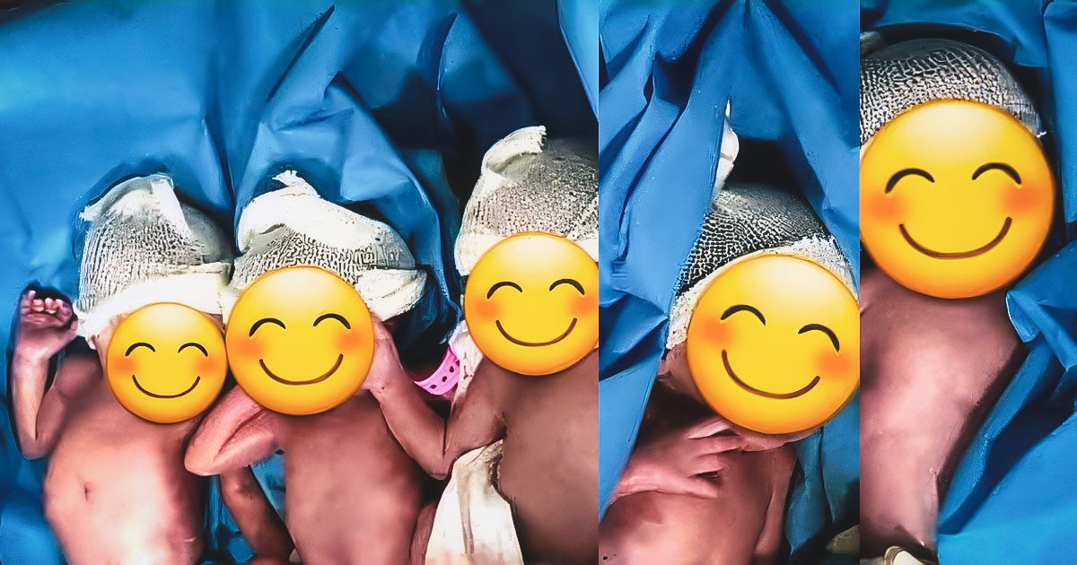 Algérie : Une femme donne naissance à des quintuplés à Alger